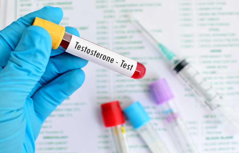 testosteron